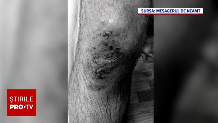 Un preot a fost bătut cu pumnii și picioarele pe o uliță din Neamț, în fața familiei. Trei bărbați au fost reținuți