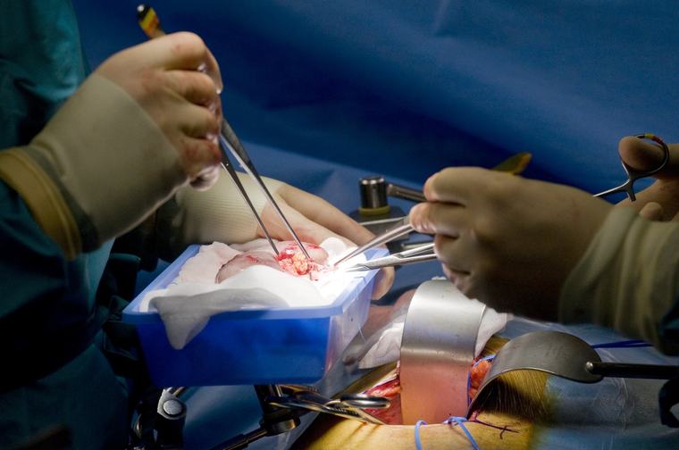 Record medical. Un rinichi de porc transplantat a funcţionat în corpul unui pacient din SUA timp de 271 de zile